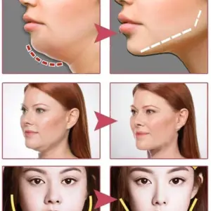 Face-lift Slimming Cream