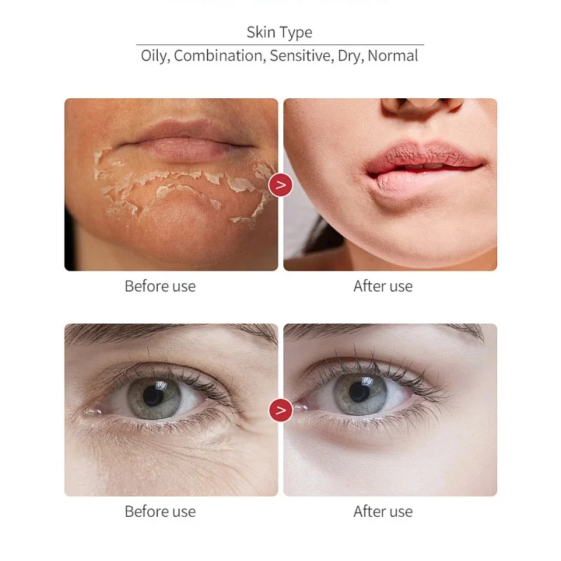 Dragon Blood Wrinkle Remover Serum - Image 3